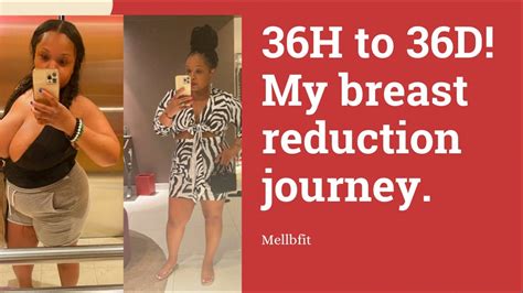 23 Years Old, Breast Reduction 36D to a 36B .